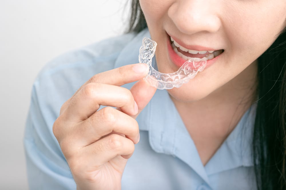 I Wore Braces As A Teen And My Teeth Still Shifted: 3 Reasons Invisalign For Adults Fixed It