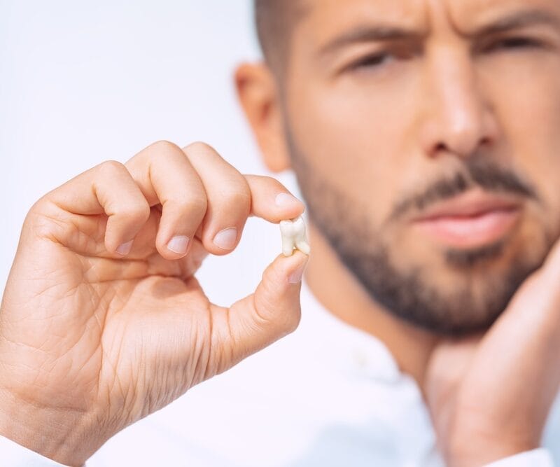 When do wisdom teeth come in? 3 Factors That May Affect Eruption Timing