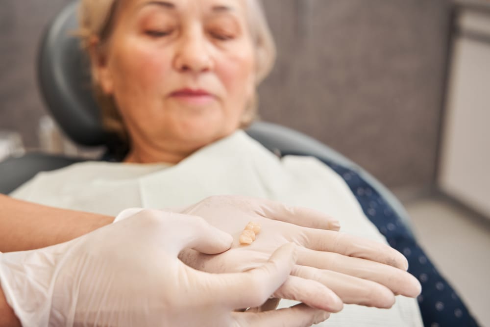 Crown Dental Treatment vs. a Filling: 4 Signs You Need More Than a Filling